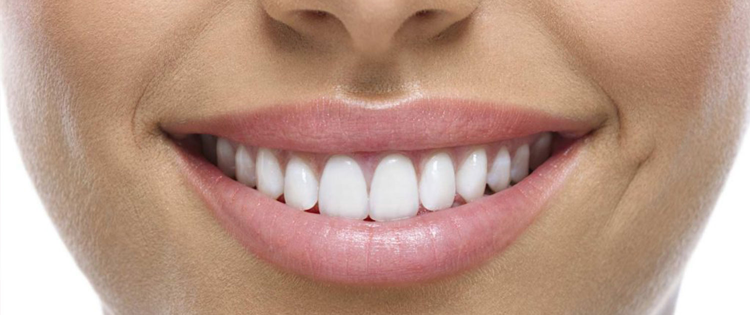 جراحی افزایش طول تاج دندان در مشهد